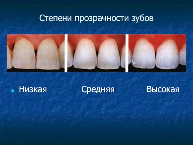 Степени прозрачности зубов Низкая Средняя Высокая