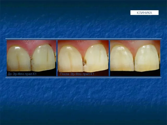 QUANTITY КЛИНИКА До Эр-Фло преп К1 После Эр-Фло преп К1
