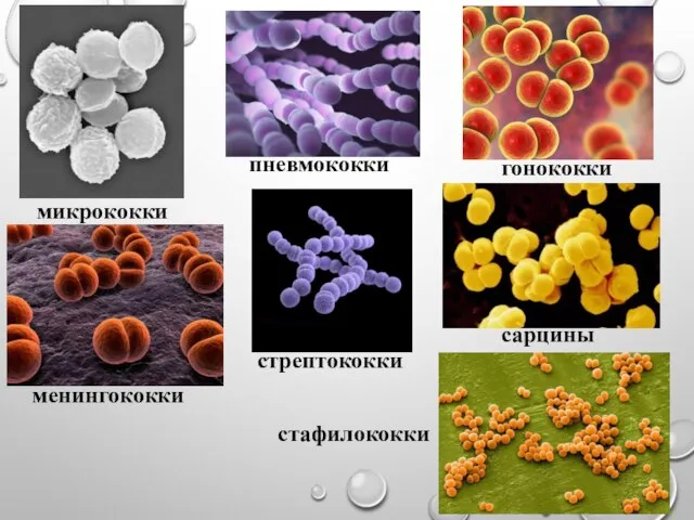 микрококки пневмококки гонококки менингококки стрептококки сарцины стафилококки