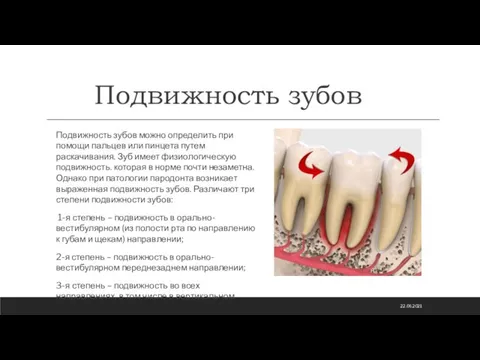 Подвижность зубов Подвижность зубов можно определить при помощи пальцев или пинцета