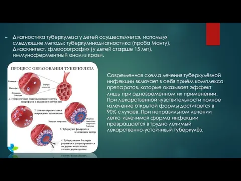 Диагностика туберкулеза у детей осуществляется, используя следующие методы: туберкулинодиагностика (проба Манту),