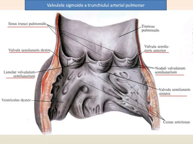 Valvulele sigmoide a trunchiului arterial pulmonar