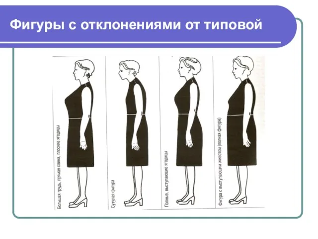 Фигуры с отклонениями от типовой