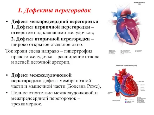 I. Дефекты перегородок Дефект межпредсердной перегородки 1. Дефект первичной перегородки –