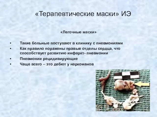 «Терапевтические маски» ИЭ «Легочные маски» Такие больные поступают в клинику с