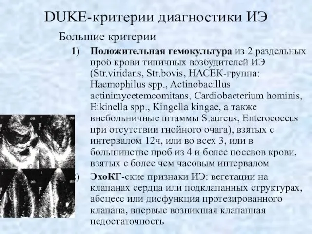 DUKE-критерии диагностики ИЭ Большие критерии Положительная гемокультура из 2 раздельных проб