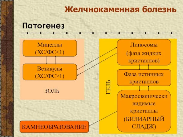 Желчнокаменная болезнь Патогенез