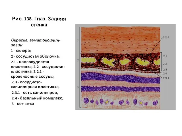 Рис. 138. Глаз. Задняя стенка Окраска: гематоксилин-эозин 1 - склера; 2