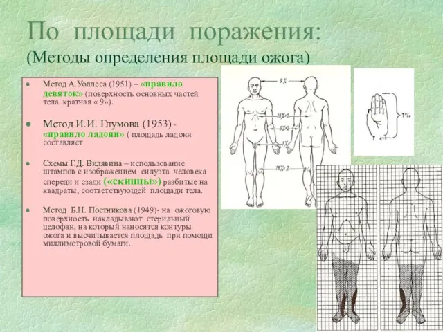 По площади поражения: (Методы определения площади ожога) Метод А.Уоллеса (1951) –