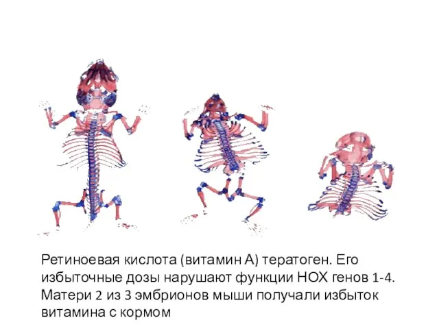 Ретиноевая кислота (витамин А) тератоген. Его избыточные дозы нарушают функции НОХ