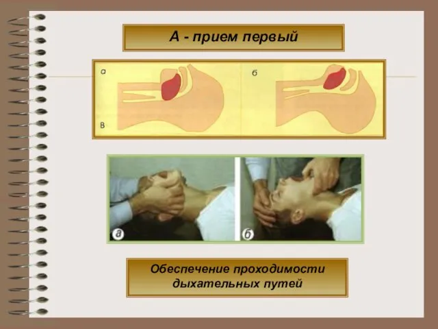 Обеспечение проходимости дыхательных путей А - прием первый