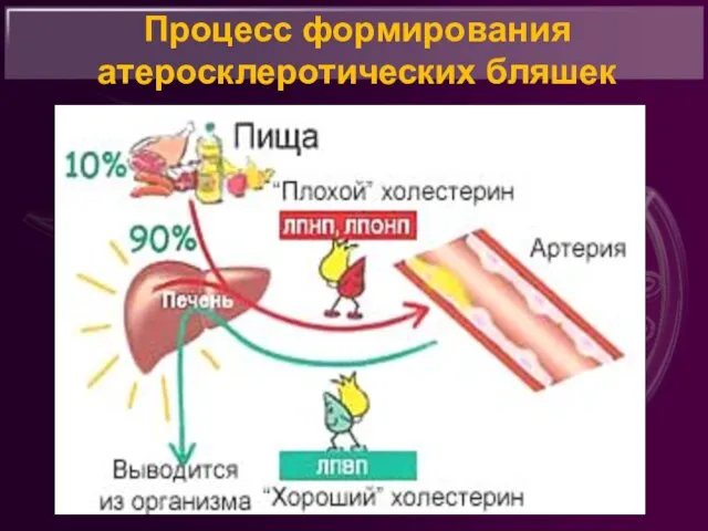 Процесс формирования атеросклеротических бляшек