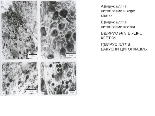 А)вирус илт в цитоплазме и ядре клетки Б)вирус илт в цитоплазме
