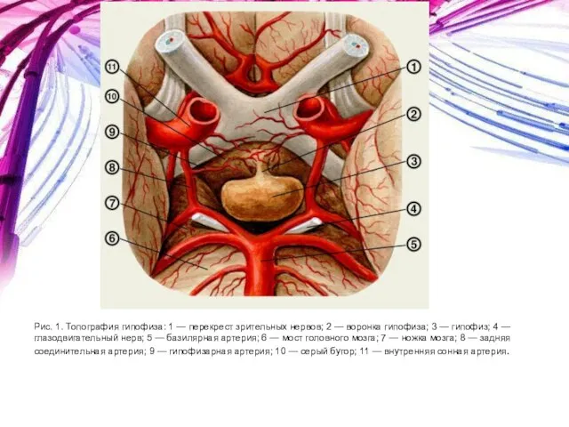 Рис. 1. Топография гипофиза: 1 — перекрест зрительных нервов; 2 —