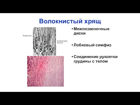 Волокнистый хрящ Межпозвоночные диски Лобковый симфиз Соединение рукоятки грудины с телом