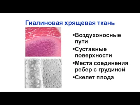 Гиалиновая хрящевая ткань Воздухоносные пути Суставные поверхности Места соединения ребер с грудиной Скелет плода