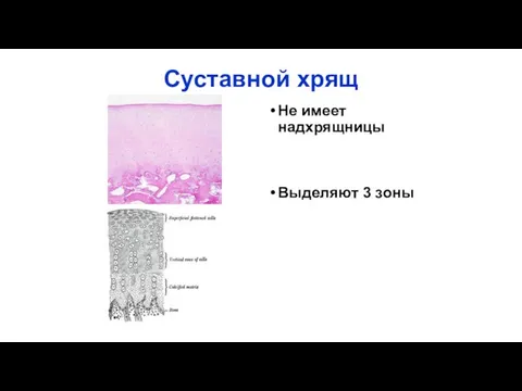 Суставной хрящ Не имеет надхрящницы Выделяют 3 зоны