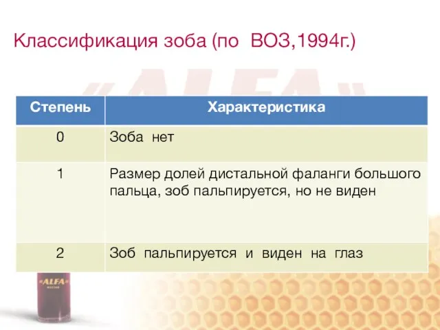 Классификация зоба (по ВОЗ,1994г.)