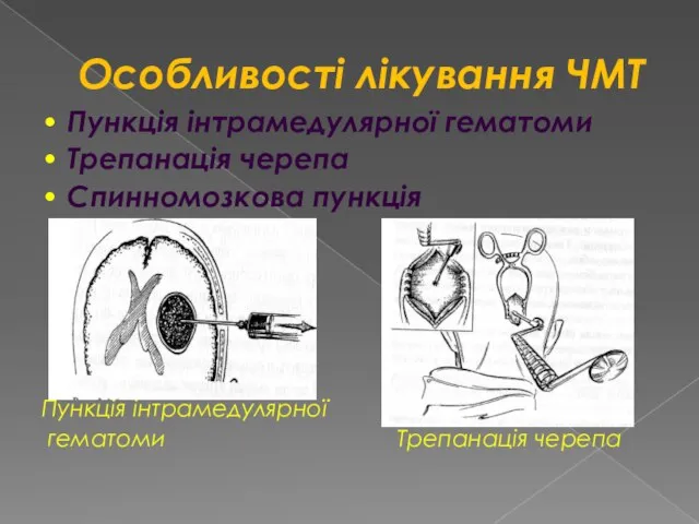 Особливості лікування ЧМТ • Пункція інтрамедулярної гематоми • Трепанація черепа •