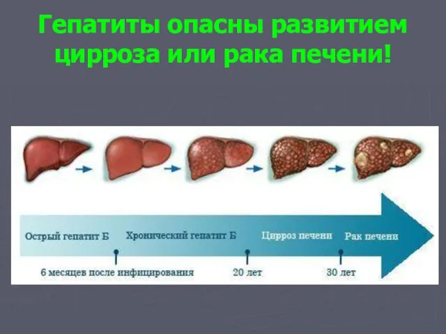 Гепатиты опасны развитием цирроза или рака печени!