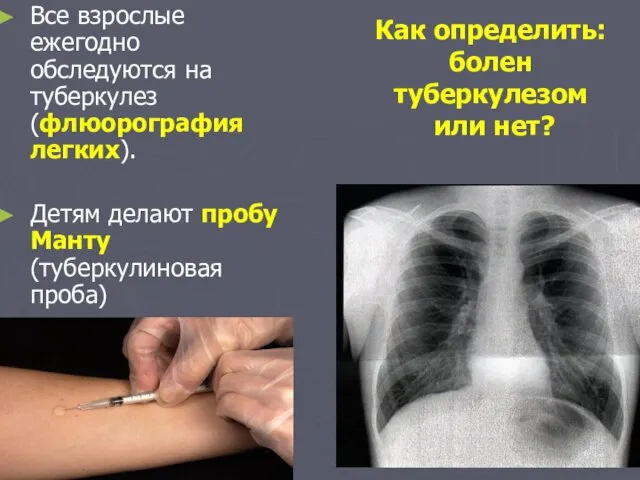 Как определить: болен туберкулезом или нет? Все взрослые ежегодно обследуются на