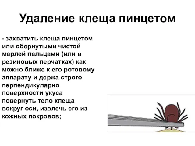 Удаление клеща пинцетом - захватить клеща пинцетом или обернутыми чистой марлей