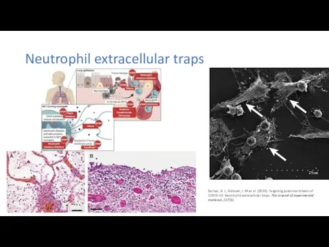 Neutrophil extracellular traps Barnes, B. J., Adrover, J. M et al.