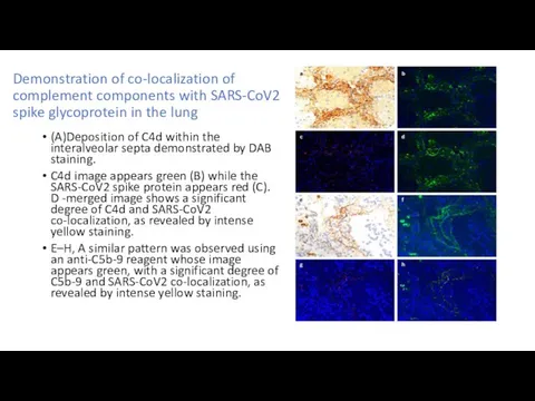 Demonstration of co-localization of complement components with SARS-CoV2 spike glycoprotein in