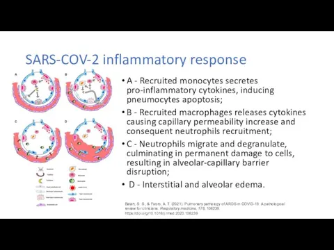 SARS-COV-2 inflammatory response A - Recruited monocytes secretes pro-inflammatory cytokines, inducing