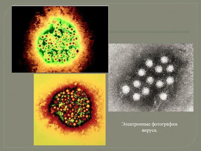 Электронные фотографии вируса.