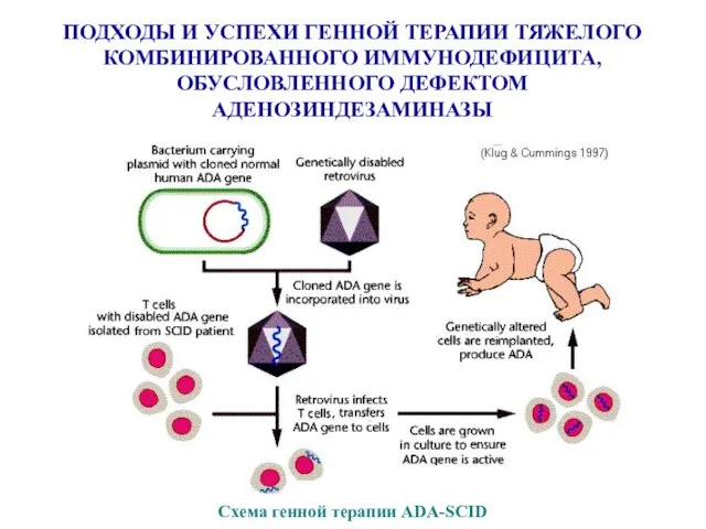 ПОДХОДЫ И УСПЕХИ ГЕННОЙ ТЕРАПИИ ТЯЖЕЛОГО КОМБИНИРОВАННОГО ИММУНОДЕФИЦИТА, ОБУСЛОВЛЕННОГО ДЕФЕКТОМ АДЕНОЗИНДЕЗАМИНАЗЫ Схема генной терапии ADA-SCID