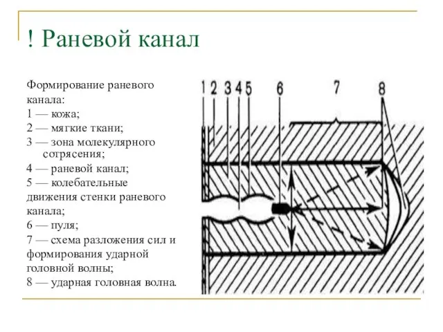 ! Раневой канал Формирование раневого канала: 1 — кожа; 2 —