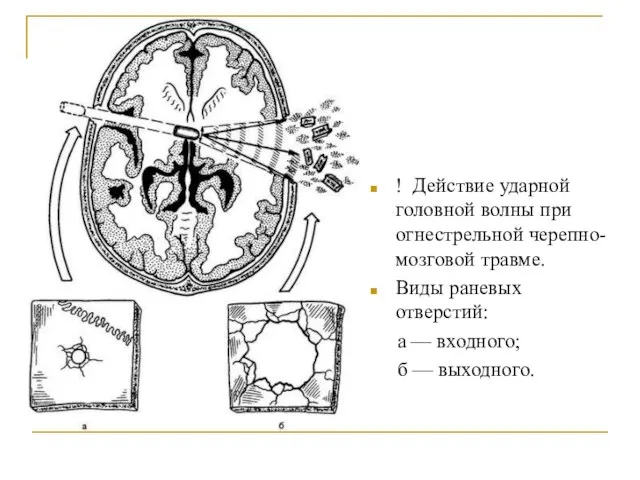 ! Действие ударной головной волны при огнестрельной черепно-мозговой травме. Виды раневых