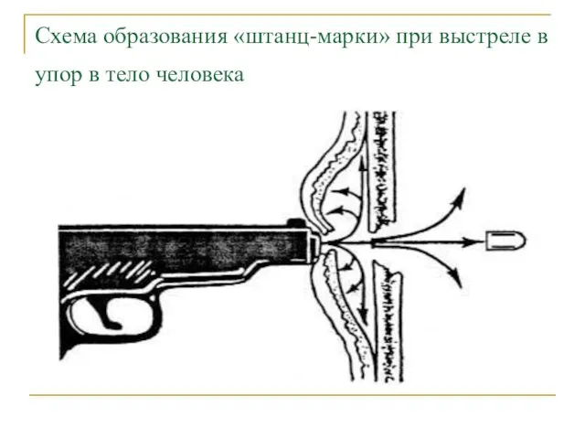 Схема образования «штанц-марки» при выстреле в упор в тело человека