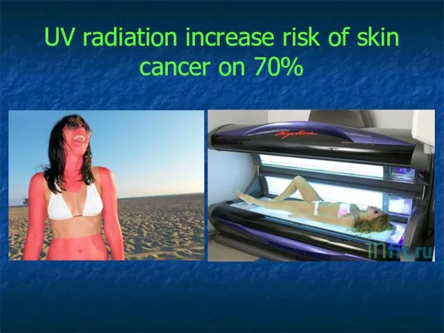 UV radiation increase risk of skin cancer on 70%