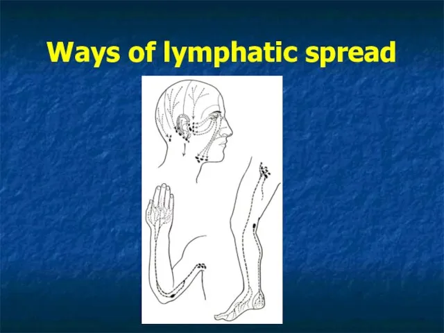 Ways of lymphatic spread