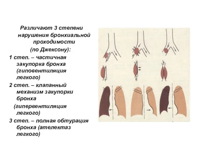 Различают 3 степени нарушения бронхиальной проходимости (по Джексону): 1 степ. –