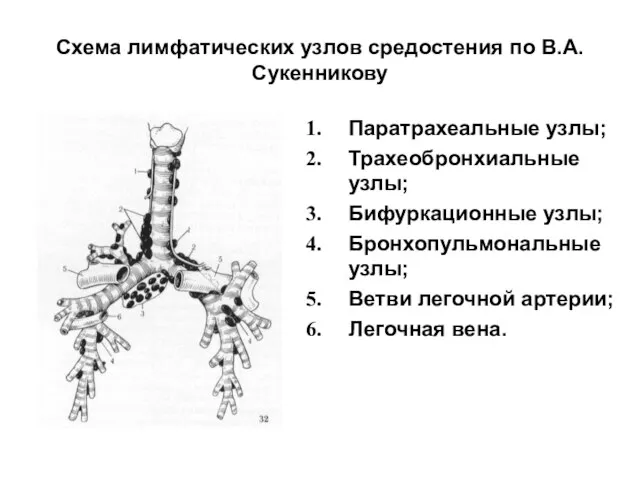 Схема лимфатических узлов средостения по В.А.Сукенникову Паратрахеальные узлы; Трахеобронхиальные узлы; Бифуркационные