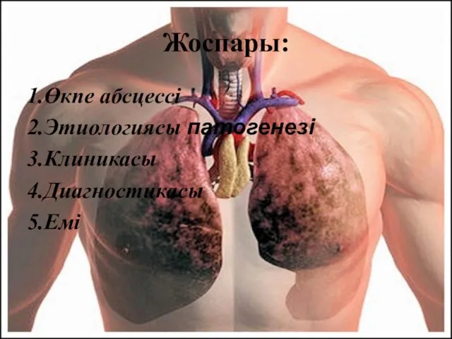 Жоспары: 1.Өкпе абсцессі 2.Этиологиясы патогенезі 3.Клиникасы 4.Диагностикасы 5.Емі