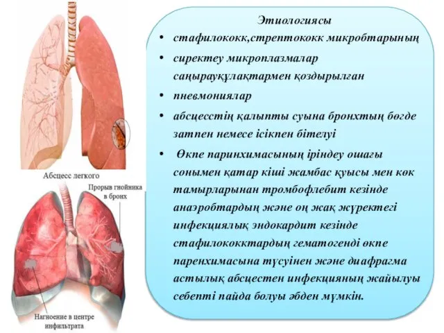 Этиологиясы стафилококк,стрептококк микробтарының сиректеу микроплазмалар саңырауқұлақтармен қоздырылған пневмониялар абсцесстің қалыпты суына