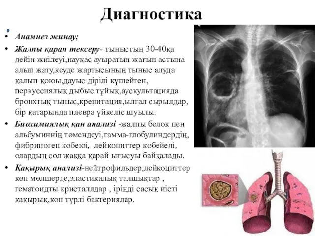 Диагностика Анамнез жинау; Жалпы қарап тексеру- тыныстың 30-40қа дейін жиілеуі,науқас ауыратын