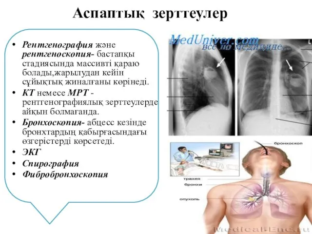 Аспаптық зерттеулер Рентгенография және рентгеноскопия- бастапқы стадиясында массивті қараю болады,жарылудан кейін