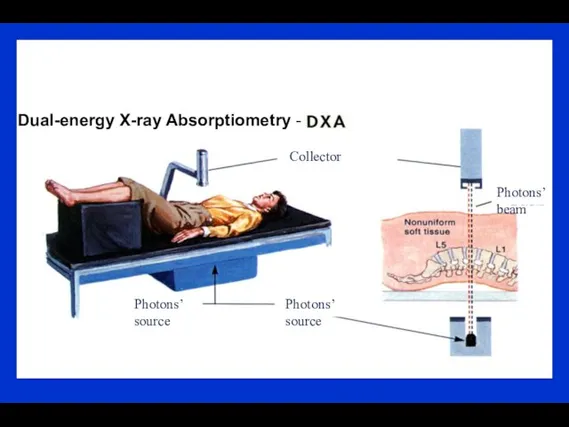 Dual-energy X-ray Absorptiometry - Photons’ source Photons’ source Photons’ beam Collector