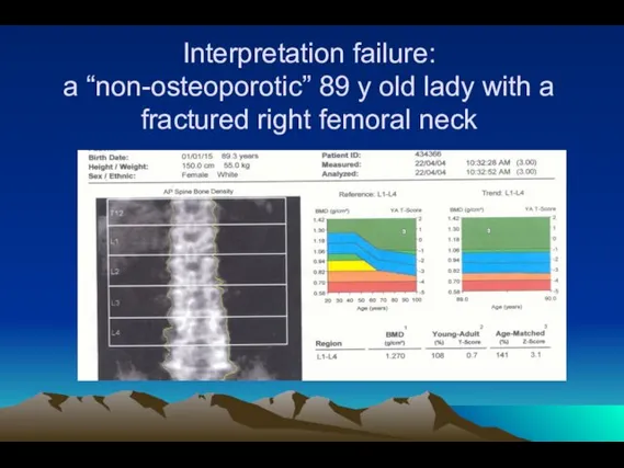 Interpretation failure: a “non-osteoporotic” 89 y old lady with a fractured right femoral neck