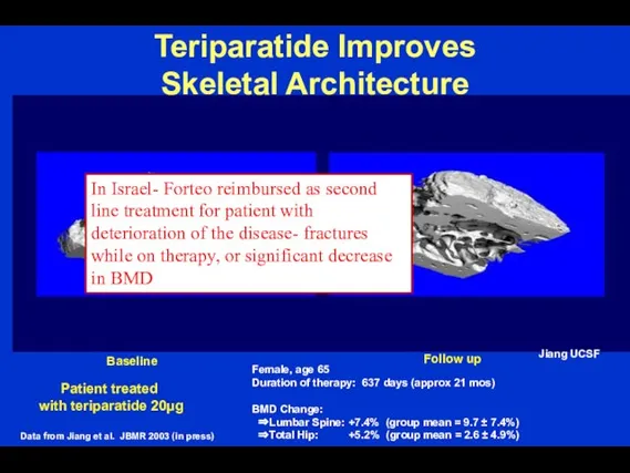 Teriparatide Improves Skeletal Architecture Patient treated with teriparatide 20µg Female, age