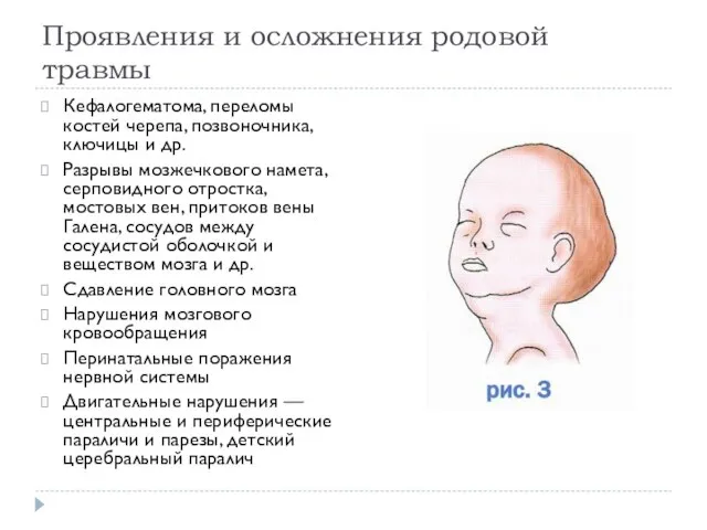 Проявления и осложнения родовой травмы Кефалогематома, переломы костей черепа, позвоночника, ключицы