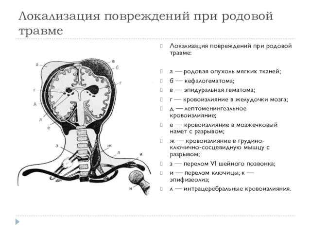 Локализация повреждений при родовой травме Локализация повреждений при родовой травме: а