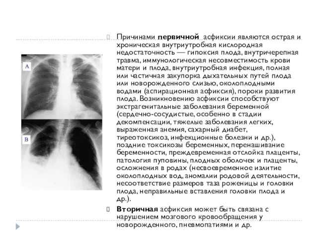 Причинами первичной асфиксии являются острая и хроническая внутриутробная кислородная недостаточность —