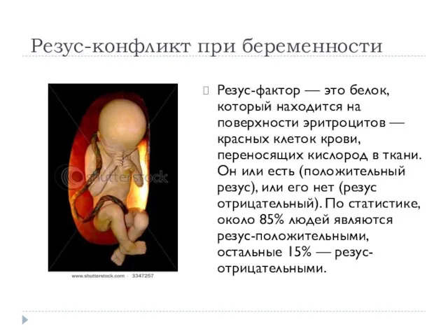 Резус-конфликт при беременности Резус-фактор — это белок, который находится на поверхности