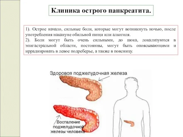 Клиника острого панкреатита. 1). Острое начало, сильные боли, которые могут возникнуть